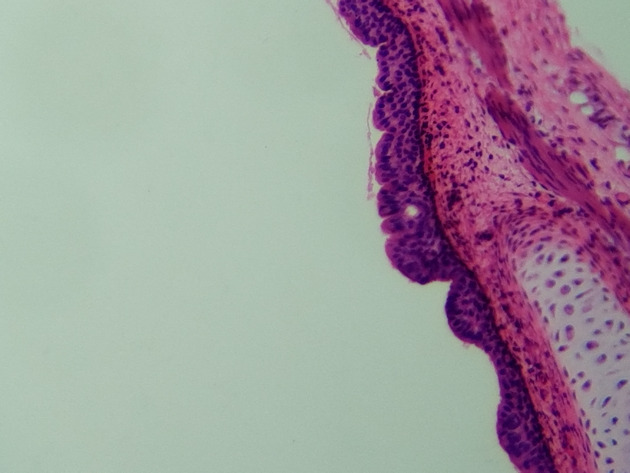 Pseudostratified Epithelium Slides - Pseudostratified Epithelium 04 100X